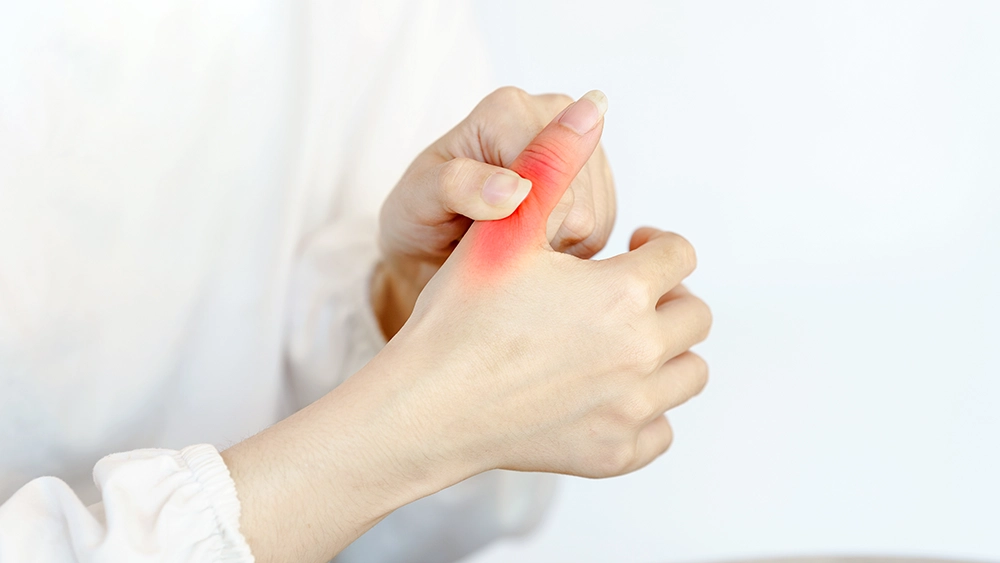 Gamekeeper’s thumb pain at the UCL with swelling at the thumb joint